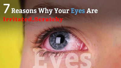 7 Reasons of Irritated and Scratchy Eyes