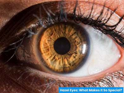 Hazel Eyes: What Makes It So Special?